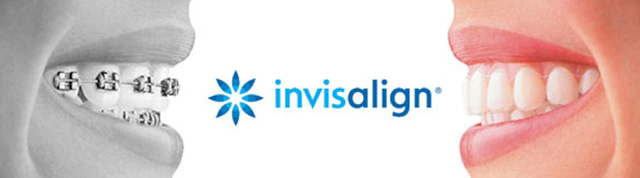Invisalign