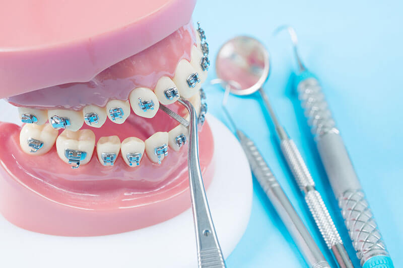 Comprehensive Treatment